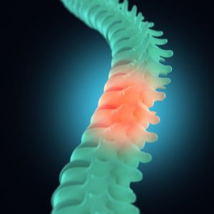 Spinal Cord Injury Attorneys Bucks County PA