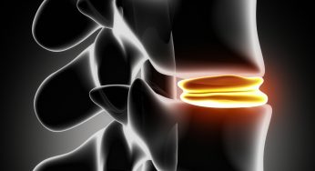 Herniated Disk Injuries in Pennsylvania