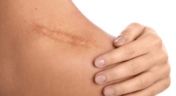 Scarring, Facial Injuries, and Disfigurement in Pennsylvania