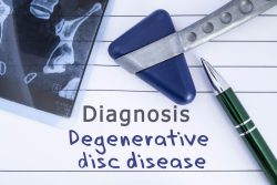 How a Car Accident Can Worsen a Degenerative Disc Disease Condition in Pennsylvania